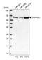 Cell Cycle Associated Protein 1 antibody, HPA018126, Atlas Antibodies, Western Blot image 