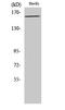 Kinase Insert Domain Receptor antibody, STJ90270, St John