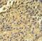 Cathepsin H antibody, LS-C100568, Lifespan Biosciences, Immunohistochemistry paraffin image 