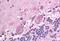NDC80 Kinetochore Complex Component antibody, MBS245080, MyBioSource, Immunohistochemistry paraffin image 