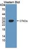 AXL Receptor Tyrosine Kinase antibody, LS-C373754, Lifespan Biosciences, Western Blot image 