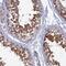 Steroid Receptor RNA Activator 1 antibody, PA5-60770, Invitrogen Antibodies, Immunohistochemistry frozen image 