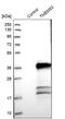 Transmembrane Protein 53 antibody, PA5-54332, Invitrogen Antibodies, Western Blot image 