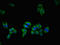 Ubiquilin 2 antibody, LS-C675091, Lifespan Biosciences, Immunofluorescence image 