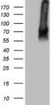 Transforming Growth Factor Beta Receptor 2 antibody, TA808048S, Origene, Western Blot image 