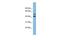 Ankyrin repeat and MYND domain-containing protein 2 antibody, GTX44921, GeneTex, Western Blot image 