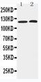 Histone Deacetylase 5 antibody, PA2180, Boster Biological Technology, Western Blot image 