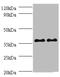 SPT3 Homolog, SAGA And STAGA Complex Component antibody, A54487-100, Epigentek, Western Blot image 