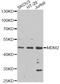 MDM2 Proto-Oncogene antibody, MBS127663, MyBioSource, Western Blot image 
