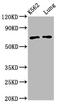 POF1B Actin Binding Protein antibody, LS-C681084, Lifespan Biosciences, Western Blot image 