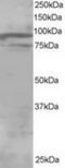 Oxysterol Binding Protein Like 11 antibody, TA302906, Origene, Western Blot image 