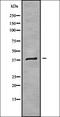 Inner Mitochondrial Membrane Peptidase Subunit 2 antibody, orb338426, Biorbyt, Western Blot image 