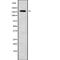 ATP Binding Cassette Subfamily C Member 6 antibody, PA5-68233, Invitrogen Antibodies, Western Blot image 