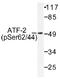 Activating Transcription Factor 2 antibody, AP01529PU-N, Origene, Western Blot image 