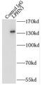 Adhesion G Protein-Coupled Receptor L3 antibody, FNab04829, FineTest, Immunoprecipitation image 