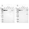 Nuclear Factor Kappa B Subunit 2 antibody, NBP1-87760, Novus Biologicals, Western Blot image 