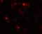 Autophagy Related 2B antibody, A11053, Boster Biological Technology, Immunofluorescence image 