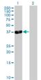 PDZ And LIM Domain 3 antibody, H00027295-B01P, Novus Biologicals, Western Blot image 