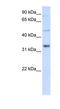 Zinc Finger CCHC-Type Containing 17 antibody, NBP1-57131, Novus Biologicals, Western Blot image 