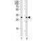 Snail Family Transcriptional Repressor 1 antibody, F47916-0.4ML, NSJ Bioreagents, Western Blot image 