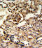 Guanine Monophosphate Synthase antibody, LS-C166540, Lifespan Biosciences, Immunohistochemistry frozen image 