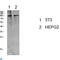 Eukaryotic Translation Elongation Factor 2 antibody, LS-C813577, Lifespan Biosciences, Western Blot image 