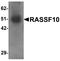 Ras association domain-containing protein 10 antibody, A12028, Boster Biological Technology, Western Blot image 