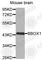 Gamma-Butyrobetaine Hydroxylase 1 antibody, A2279, ABclonal Technology, Western Blot image 