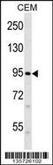 Piezo Type Mechanosensitive Ion Channel Component 2 antibody, 58-396, ProSci, Western Blot image 