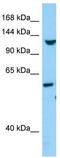 Tolloid Like 1 antibody, TA338102, Origene, Western Blot image 