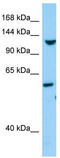 Tolloid-like protein 1 antibody, TA338102, Origene, Western Blot image 