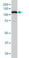 Gamma-Aminobutyric Acid Type B Receptor Subunit 1 antibody, ab55051, Abcam, Western Blot image 