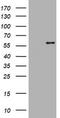ETS Proto-Oncogene 2, Transcription Factor antibody, TA505621S, Origene, Western Blot image 