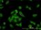 Non-SMC Condensin I Complex Subunit D2 antibody, H00009918-M01, Novus Biologicals, Immunocytochemistry image 