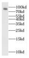 Ran-binding protein 9 antibody, FNab07104, FineTest, Western Blot image 