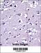 Matrix Metallopeptidase 16 antibody, 57-216, ProSci, Immunohistochemistry frozen image 