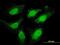 DNA Topoisomerase III Beta antibody, H00008940-M04, Novus Biologicals, Immunocytochemistry image 
