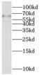 Solute Carrier Family 22 Member 1 antibody, FNab07919, FineTest, Western Blot image 