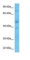 Tumor Suppressing Subtransferable Candidate 4 antibody, orb325716, Biorbyt, Western Blot image 