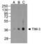 Hepatitis A Virus Cellular Receptor 2 antibody, RF16103, ProSci Inc, Western Blot image 