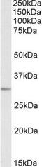 Microtubule Associated Protein RP/EB Family Member 3 antibody, GTX88277, GeneTex, Western Blot image 