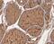 Thyroglobulin antibody, NBP2-80478, Novus Biologicals, Immunohistochemistry paraffin image 