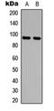 Adenosine Monophosphate Deaminase 2 antibody, orb235009, Biorbyt, Western Blot image 