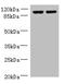 EF-Hand Domain Family Member B antibody, orb354711, Biorbyt, Western Blot image 