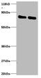 Ubiquitin thioesterase OTUB1 antibody, A53953-100, Epigentek, Western Blot image 