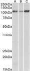 ATPase Sarcoplasmic/Endoplasmic Reticulum Ca2+ Transporting 2 antibody, TA326319, Origene, Western Blot image 