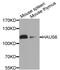 HAUS Augmin Like Complex Subunit 6 antibody, PA5-76176, Invitrogen Antibodies, Western Blot image 