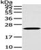 ADP Ribosylation Factor Like GTPase 2 antibody, TA323131, Origene, Western Blot image 