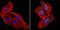 RAD51 Recombinase antibody, MA5-14419, Invitrogen Antibodies, Immunofluorescence image 