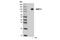 SUZ12 Polycomb Repressive Complex 2 Subunit antibody, 13701S, Cell Signaling Technology, Western Blot image 